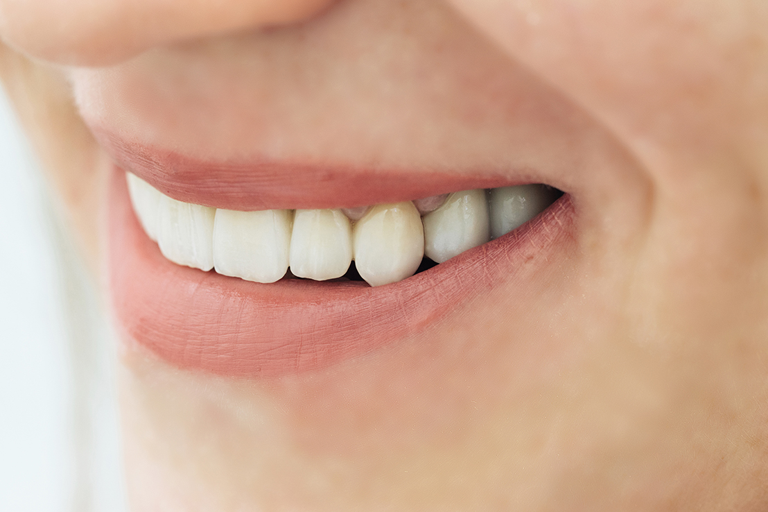 Zirkonyum İle Porselen Diş Arasında Ki Farklar